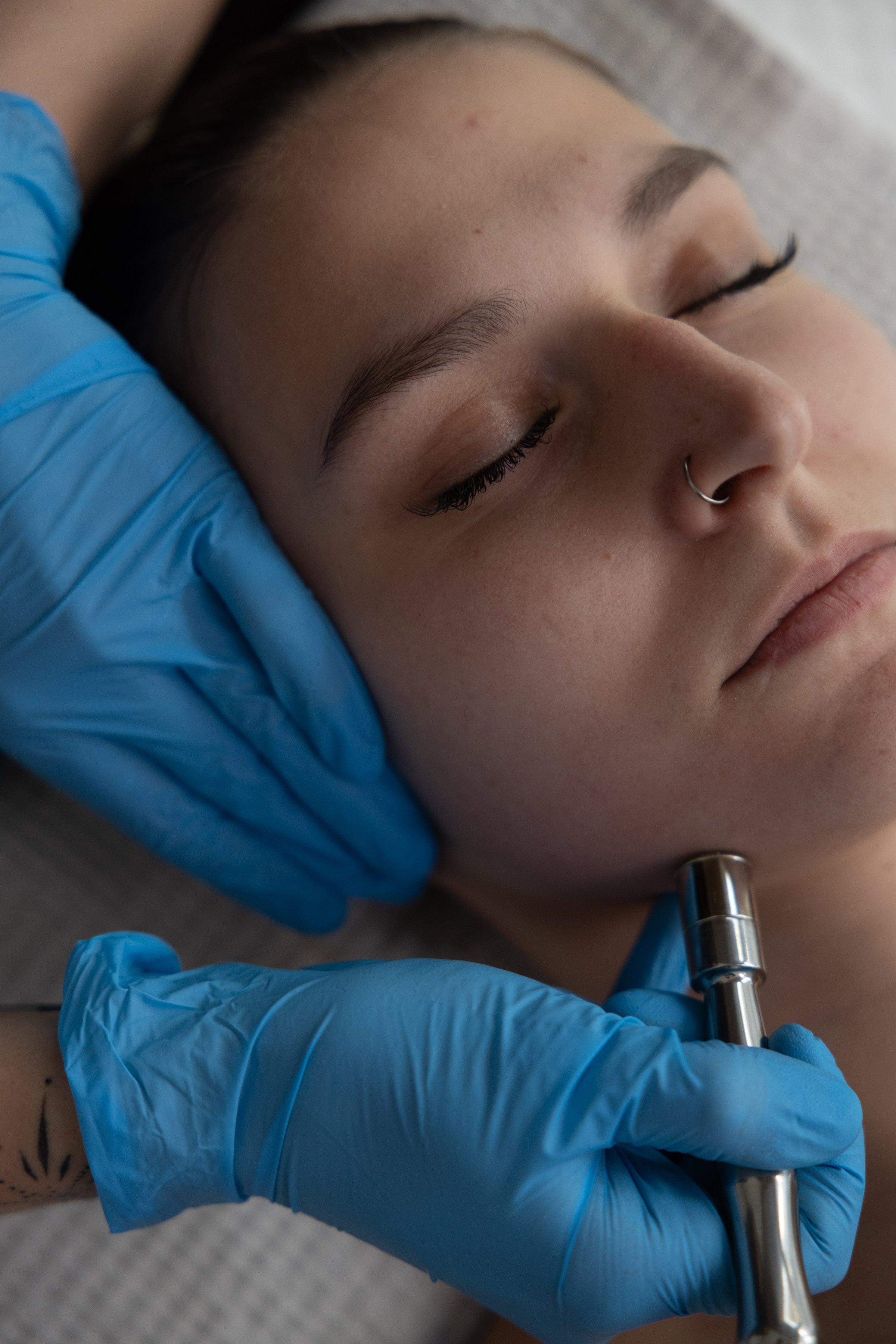 Mikrodermabrazja diamentowa